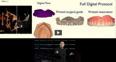Treatment of the severely atrophic maxilla - Immediate Function Episode 5