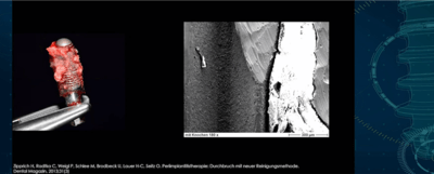 Galvosurge image