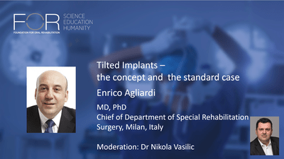 Agliardi tilted implants pt 1