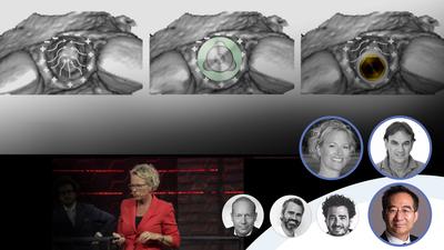 Immediate Implants Episode 2:    Implant Position
