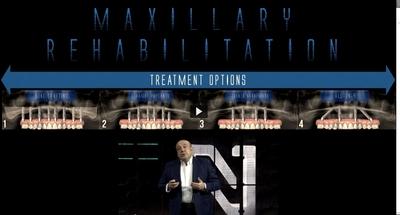 Treatment of the atrophic maxilla with soft bone - Immediate Function Episode 3