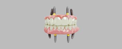 Online Course All-on-4® treatment concept