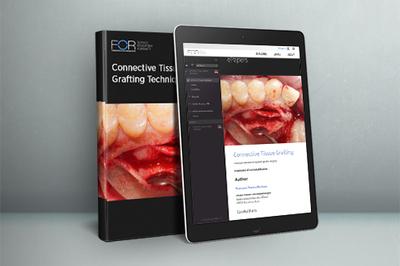 ePaper: Connective Tissue Grafting Techniques