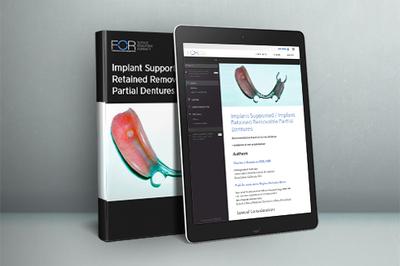 ePaper: Implant Supported / Implant Retained Removable Partial Dentures (IRPDs)