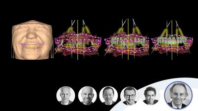 Guided or navigated surgery? Today’s digital technology