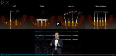 An Immediate Fixed Solution for an Edentulous Mandible - Immediate Function Episode 2