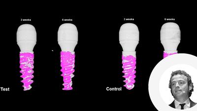 Giacomo Fabbri: New anodized surfaces designed for tissue integration at every level